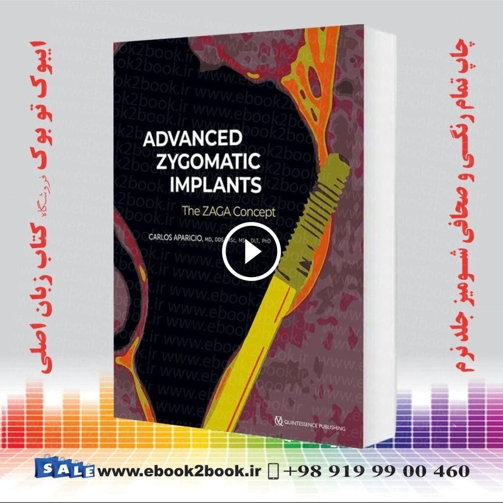Advanced Zygomatic Implants: The Zaga Concept