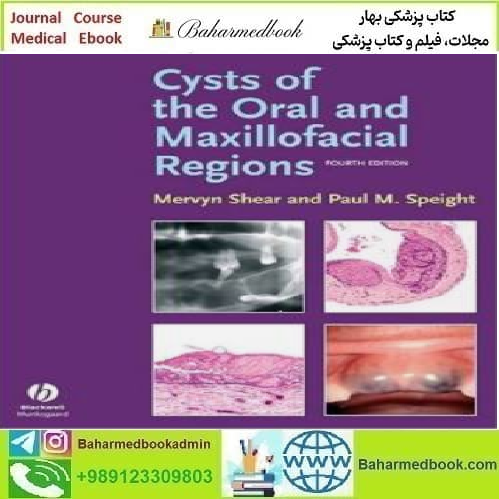 Cysts of the Oral and Maxillofacial Regions