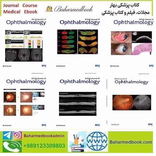 British Journal of Ophthalmology 2024 Full Archives TRUE PDF