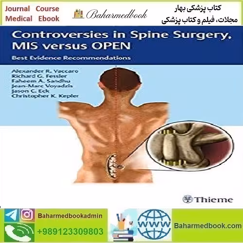 Controversies in Spine Surgery MIS versus OPEN TRUE PDF