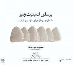 پرسلن لمینیت ونیر (20 طرح درمان برای بازسازی لبخند)