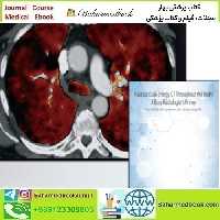 ARRS Practical Dual Energy CT Throughout the Body 2021 video