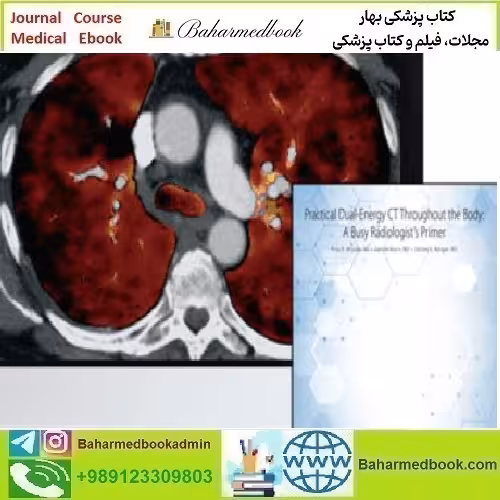 ARRS Practical Dual Energy CT Throughout the Body 2021 video