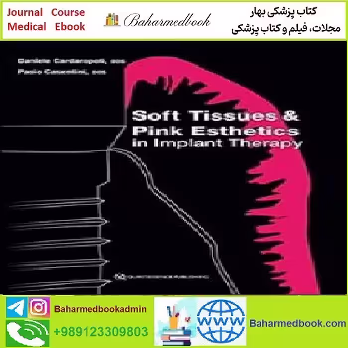 Soft Tissues and Pink Esthetics in Implant Therapy TRUE PDF p