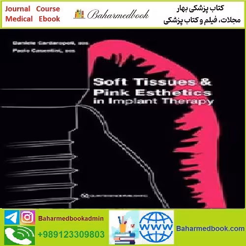 Soft Tissues and Pink Esthetics in Implant Therapy TRUE PDF p
