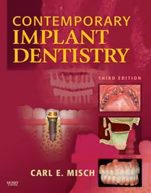 [PDF] دانلود کتاب Contemporary Implant Dentistry, 3rd ed, 2008