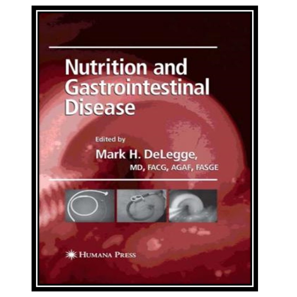 کتاب Nutrition and Gastrointestinal Disease اثر Mark H DeLeggen انتشارات مؤلفین طلایی