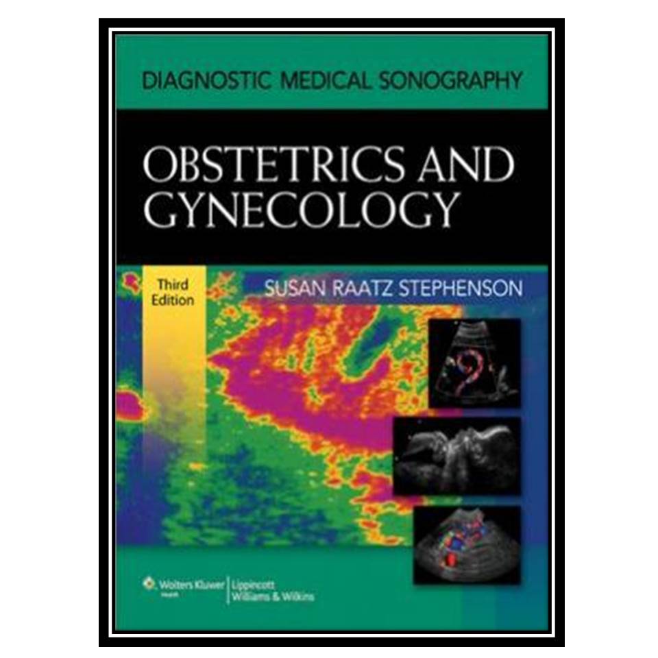 کتاب Diagnostic medical sonography Obstetrics and gynecology اثر Stephenson SRانتشارات طلایی پویندگان دانشگاه