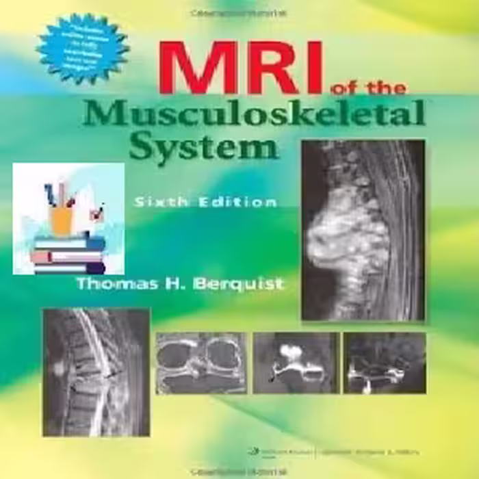 MRI of the Musculoskeletal System TRUE PDF price 1€