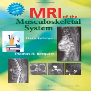 MRI of the Musculoskeletal System TRUE PDF price 1€