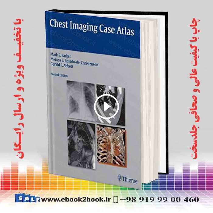Chest Imaging Case Atlas 2nd Edition