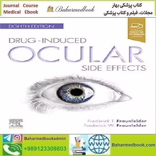 Drug Induced Ocular Side Effects Clinical Ocular Toxicology