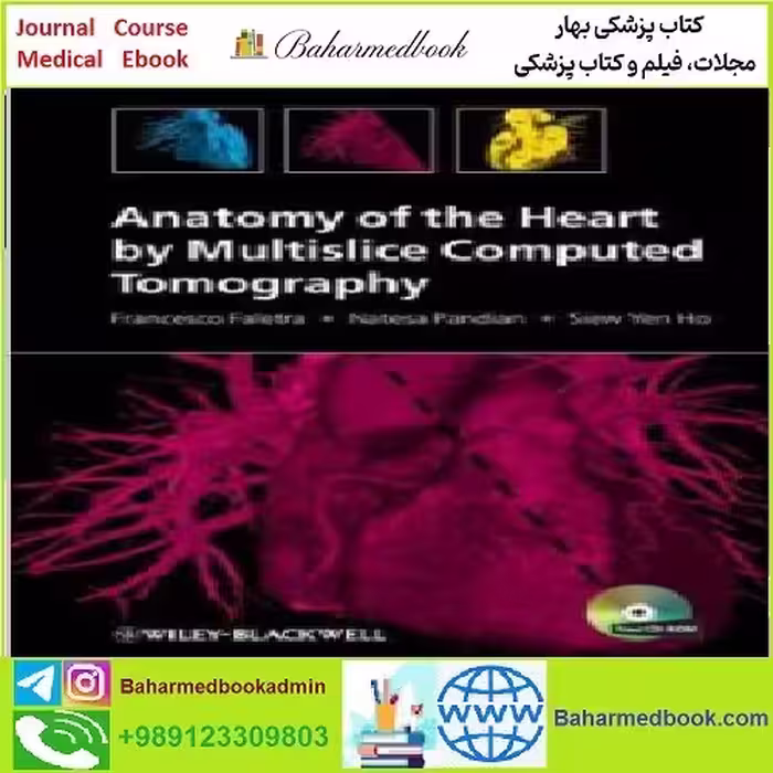Anatomy of the Heart by Multislice Computed Tomograph TRUE
