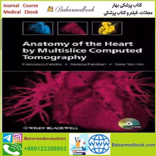 Anatomy of the Heart by Multislice Computed Tomograph TRUE