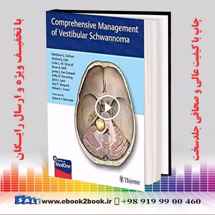 Comprehensive Management of Vestibular Schwannoma