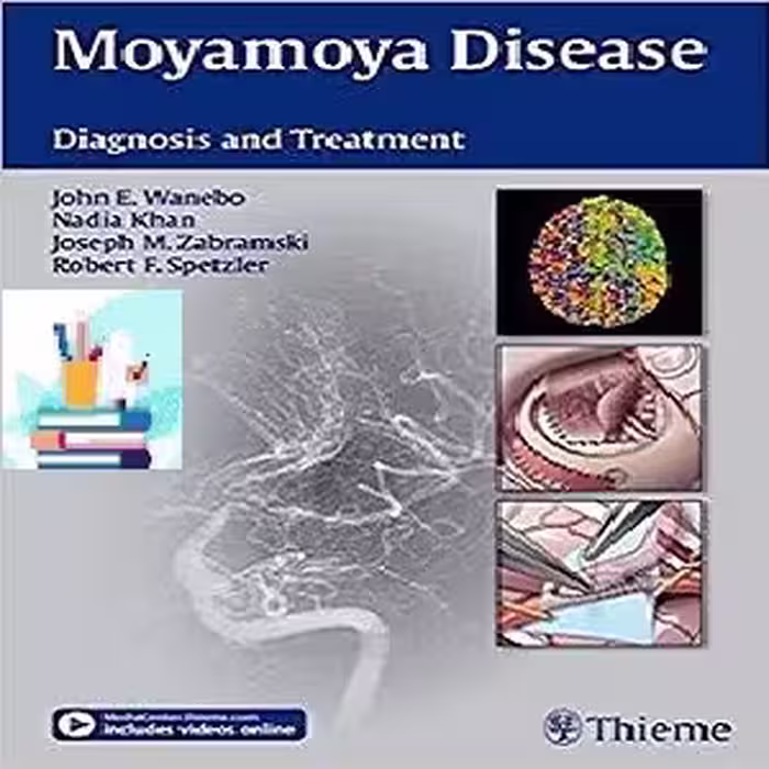 Moyamoya Disease Diagnosis and Treatment 1ed PDF Video at 5€ - کتاب پزشکی بهار