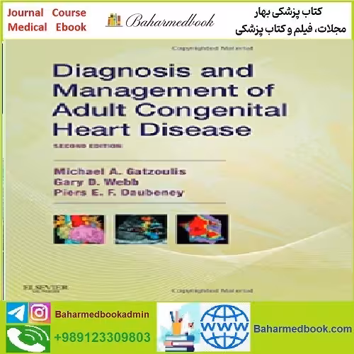 Diagnosis and Management of Adult Congenital Heart Disease