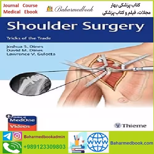 Shoulder Surgery Tricks of the Trade TRUE PDF price 1€ - کتاب پزشکی بهار