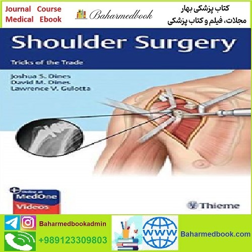 Shoulder Surgery Tricks of the Trade TRUE PDF price 1€ - کتاب پزشکی بهار