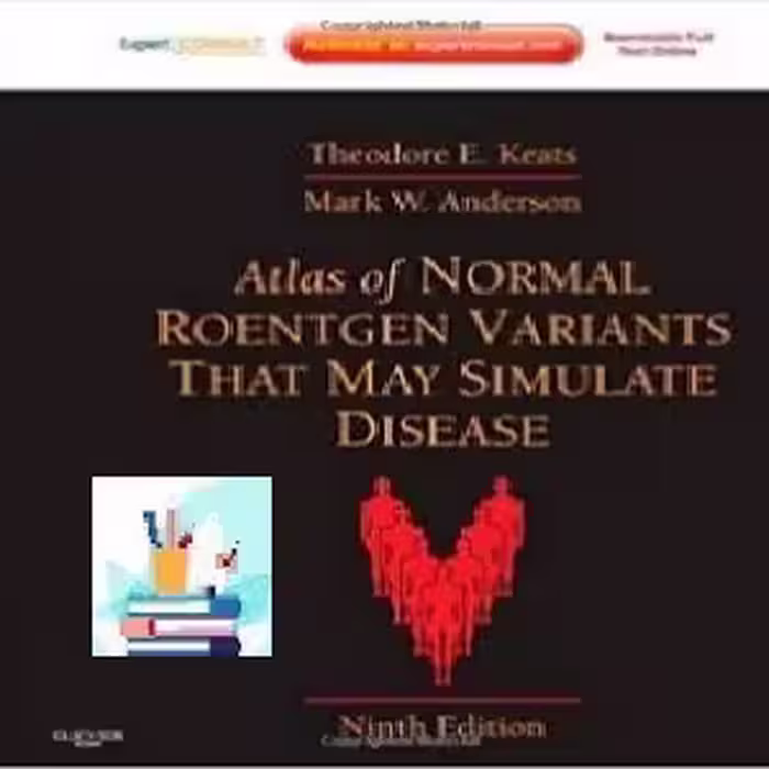 Atlas of Normal Roentgen Variants That May Simulate Disease T