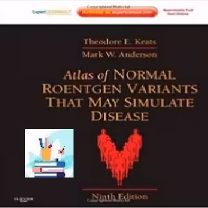 Atlas of Normal Roentgen Variants That May Simulate Disease T