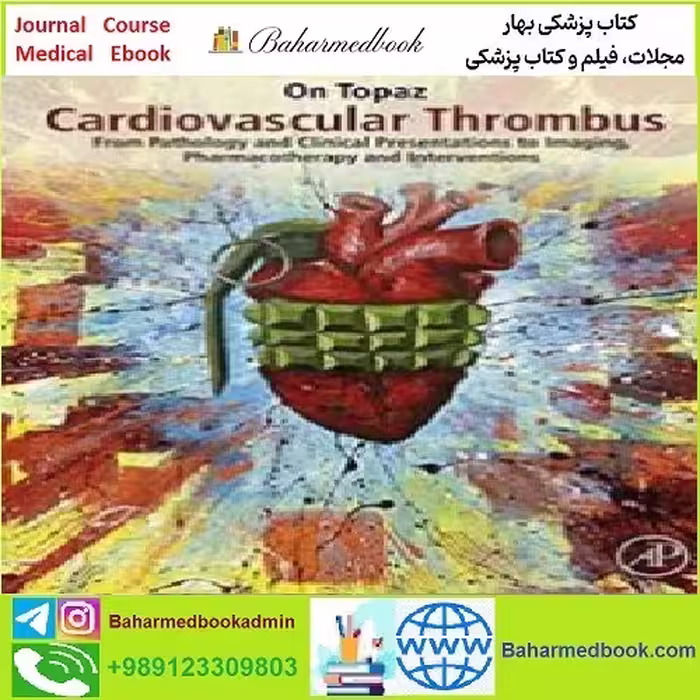 Cardiovascular Thrombus TRUE PDF price 1€ - کتاب پزشکی بهار