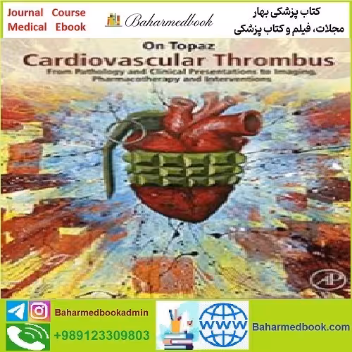 Cardiovascular Thrombus TRUE PDF price 1€ - کتاب پزشکی بهار
