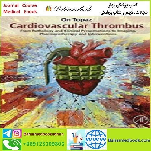 Cardiovascular Thrombus TRUE PDF price 1€ - کتاب پزشکی بهار