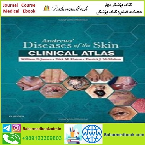Andrews' Diseases of the Skin Clinical Atlas TRUE PDF price 1€ - کتاب پزشکی بهار