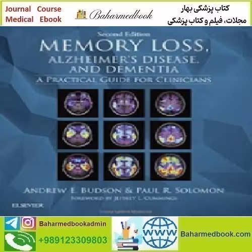 Memory Loss Alzheimer's Disease and Dementia A Practical Guid