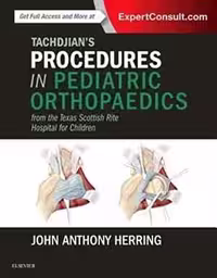 [PDF] دانلود کتاب Tachdjian’S Procedures In Pediatric Orthopaedics - From The Texas Scottish Rite Hospital For Children, 2016