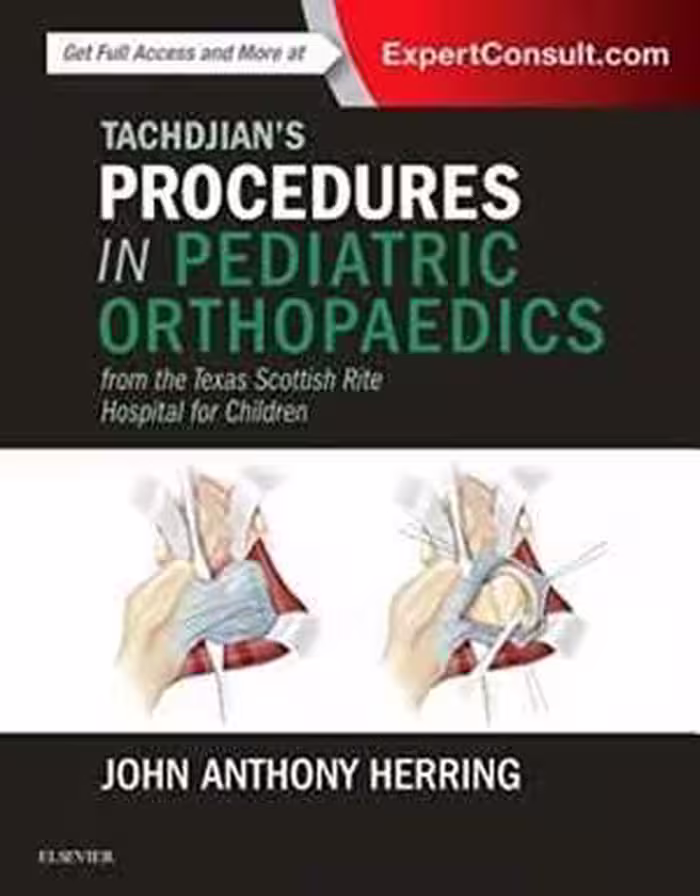 [PDF] دانلود کتاب Tachdjian’S Procedures In Pediatric Orthopaedics - From The Texas Scottish Rite Hospital For Children, 2016