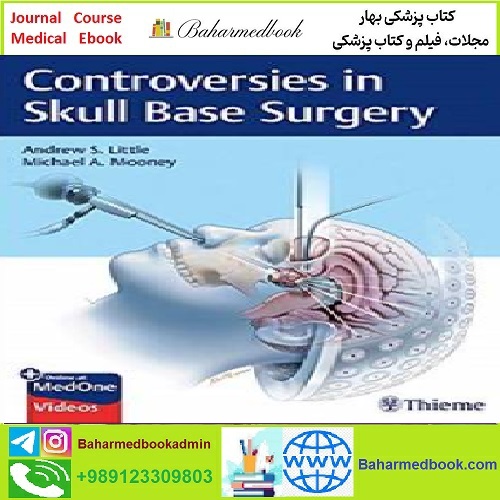 Controversies in Skull Base Surgery TRUE PDF price 1€