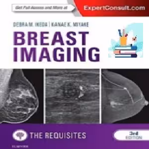 Breast Imaging TRUE PDF price 1€