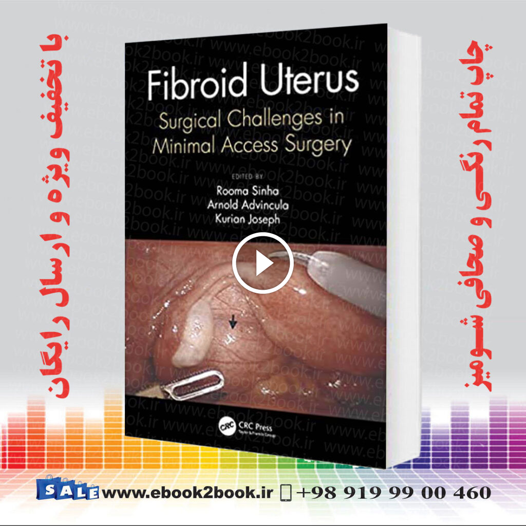 Fibroid Uterus