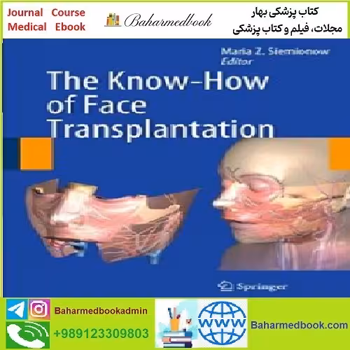 The Know How of Face Transplantation TRUE PDF price 1€ - کتاب پزشکی بهار