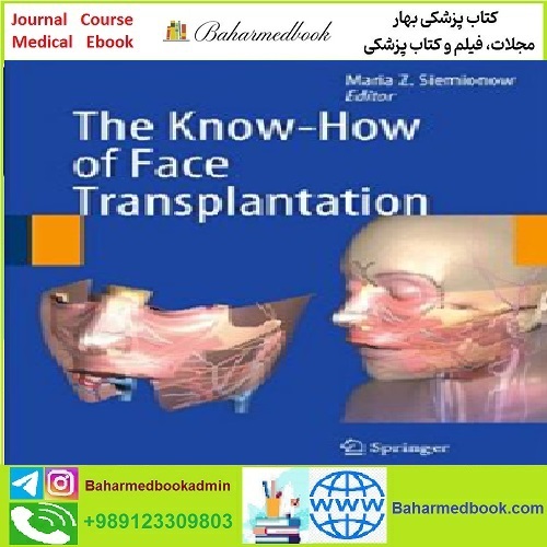 The Know How of Face Transplantation TRUE PDF price 1€ - کتاب پزشکی بهار