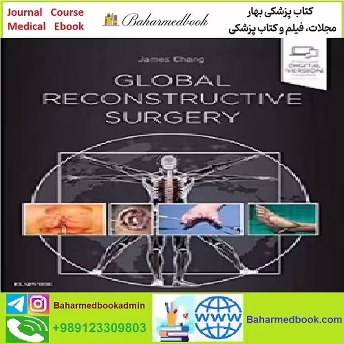 Global Reconstructive Surgery TRUE PDF price 1€