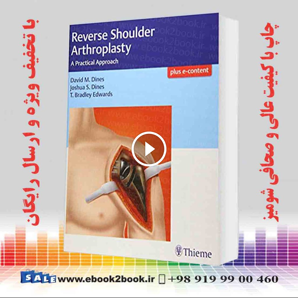 Reverse Shoulder Arthroplasty: A Practical Approach