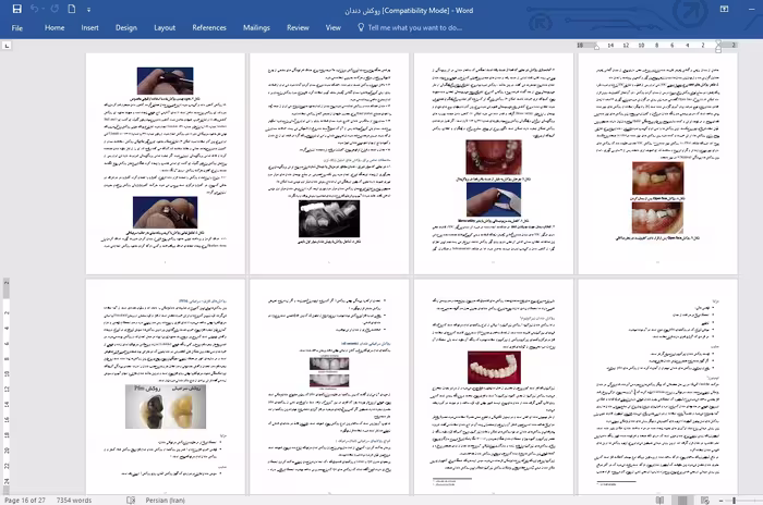 فایل مواد و نحوه ساخت انواع روكش دندان