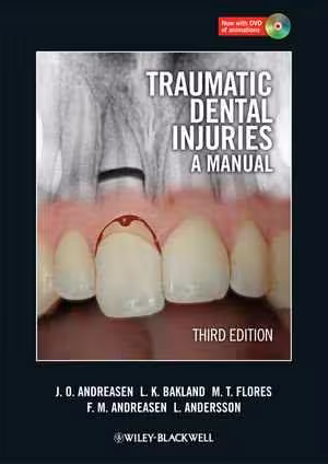 [PDF] دانلود کتاب Traumatic Dental Injuries - A Manual, 3rd ed, 2011