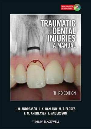 [PDF] دانلود کتاب Traumatic Dental Injuries - A Manual, 3rd ed, 2011
