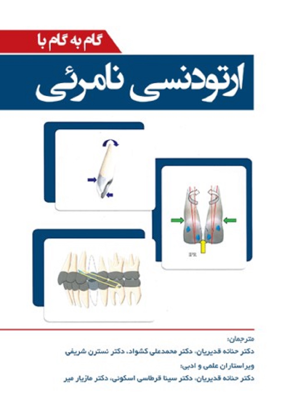 گام به گام با ارتودنسی نامرئی