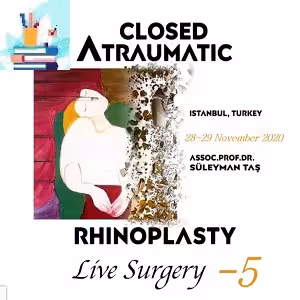 Closed Atraumatic Rhinoplasty Live-Surgery Video 5 Price 20€