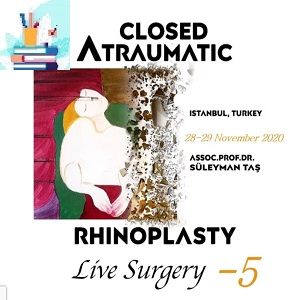 Closed Atraumatic Rhinoplasty Live-Surgery Video 5 Price 20€