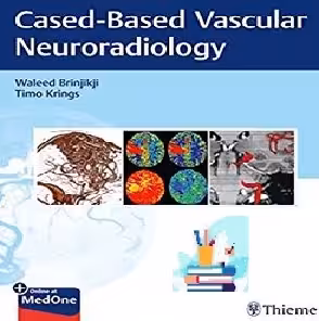 Imaging in Neurovascular Disease A Case-Based Approach TRU
