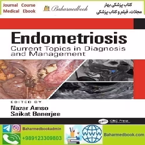 Endometriosis Current Topics in Diagnosis and Management 2022