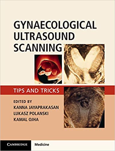 Gynaecological Ultrasound Scanning 2020 - کتاب پزشکی بهار