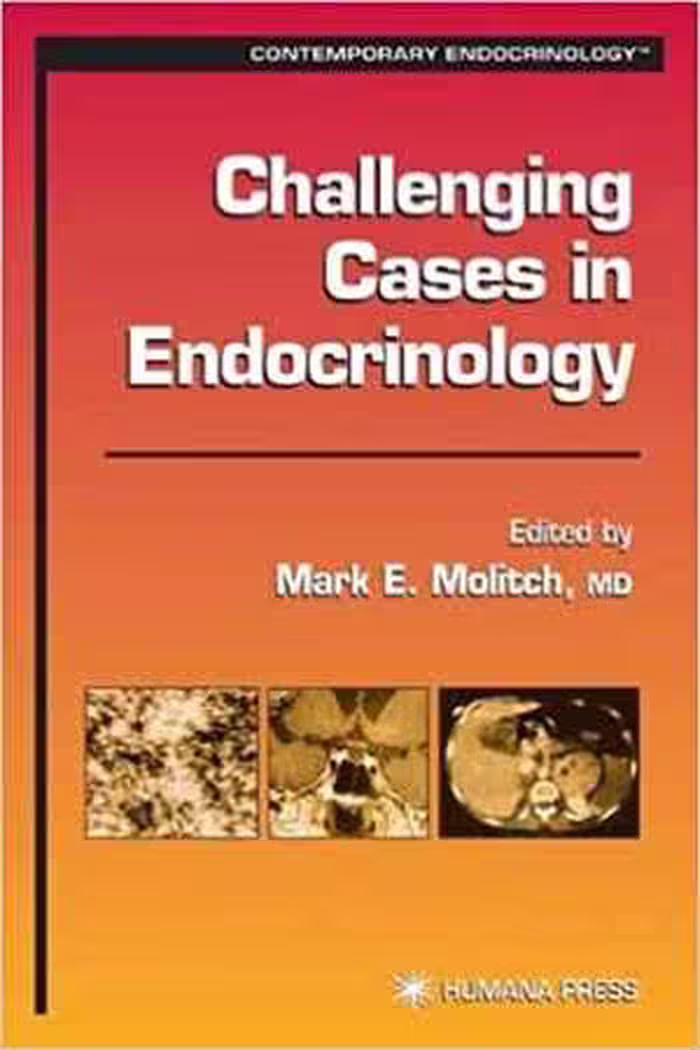 [PDF] دانلود کتاب Challenging Cases In Endorinology, 2002