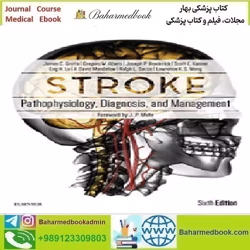 Stroke Pathophysiology Diagnosis and Management 20